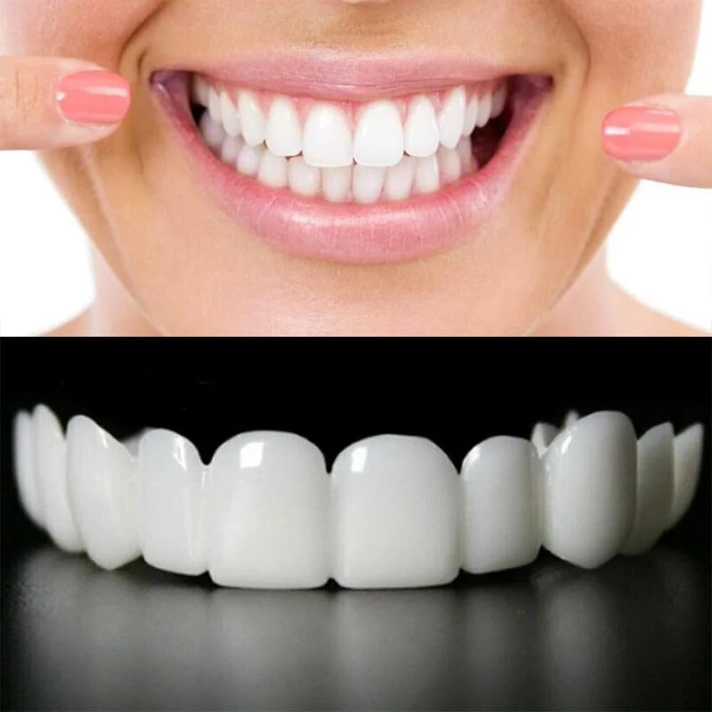 Snap On Smile - Snap On Smile
