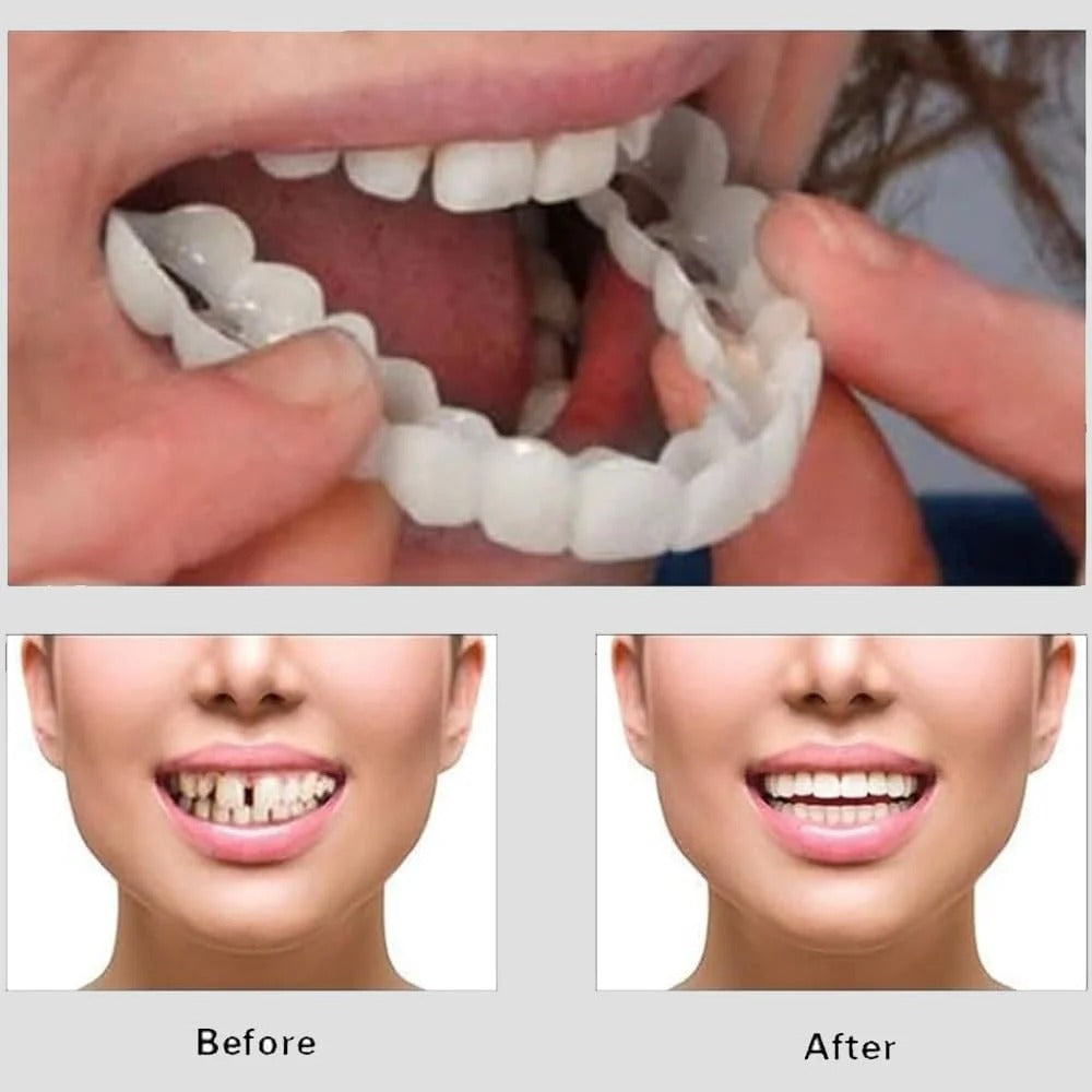 Snap On Smile - Snap On Smile